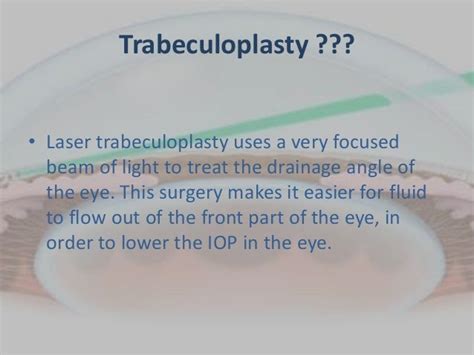 Laser trabeculoplasty