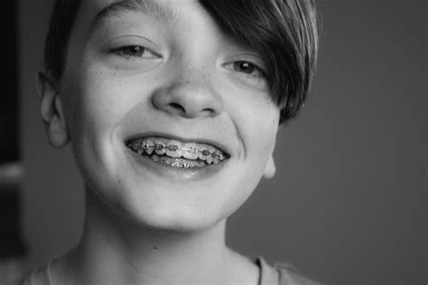 Braces for Kids—How Can Parents Help Their Children? | Pike District Smiles