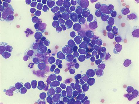 Sampling Microbiology And Cytology Of The Respiratory Tract Ivis - Bank2home.com