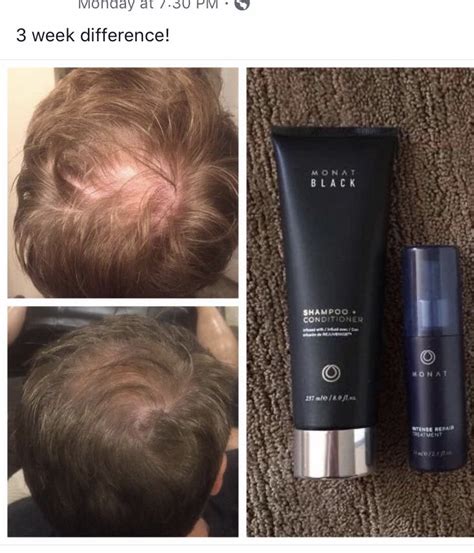 Apparently monat gives you average hair growth and different angles for ...