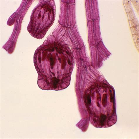 Red Algae Microscope Slides (Polysiphonia, Porphyra) | Carolina.com