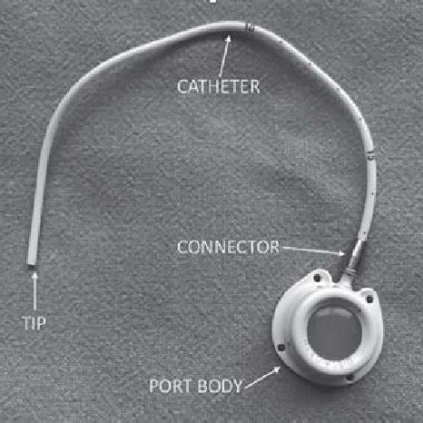 The parts of an implantable port: port body, connector, catheter and tip. | Download Scientific ...