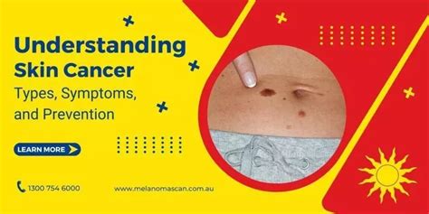 Understanding Skin Cancer | Melanoma Scan