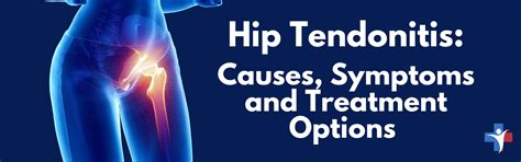 Hip tendonitis: Causes, Symptoms and Treatment Options - Primary Healthcare