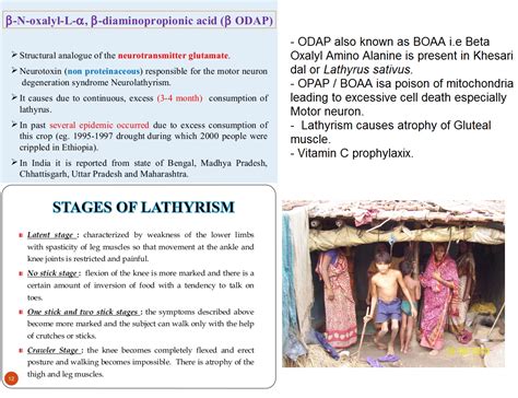 Stages Of Lathyrism