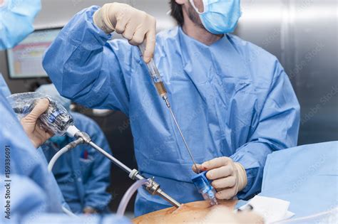 GYNECOLOGICAL SURGERY Stock Photo | Adobe Stock