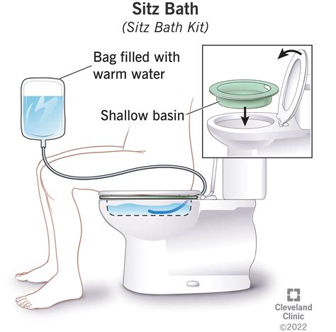 Sitz Bath: Definition & Benefits