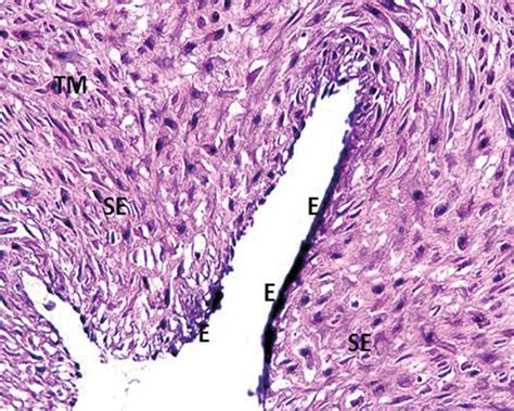 Umbilical Cord Histology