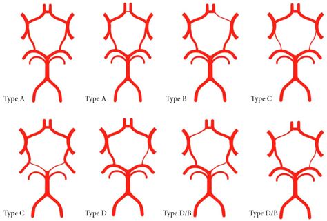 Circle Of Willis Variant Anatomy