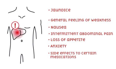 Gilbert's Syndrome GS; Causes, Symptoms, Diagnosis & Treatment