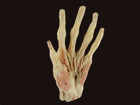 Superficial palmar arch plastinated specimens,anatomy model,anatomy teaching plastination