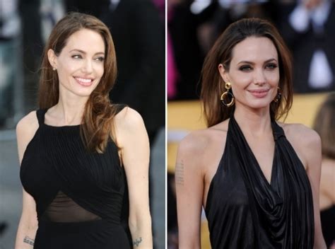 Angelina Jolie Double Mastectomy Surgery Before and After Pictures