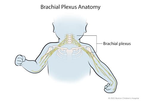 Brachial Plexus Birth Injury | Boston Children's Hospital