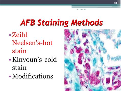 PPT - bacterial staining PowerPoint Presentation - ID:24802