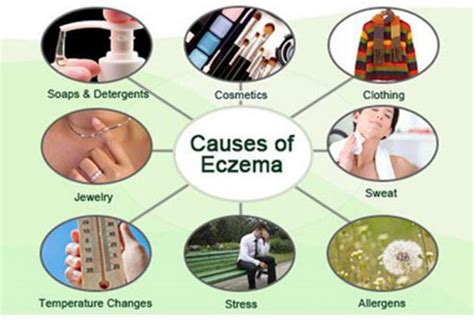 Eczema – Basic Causes, Symptoms & Treatments | Top Eczema Resource