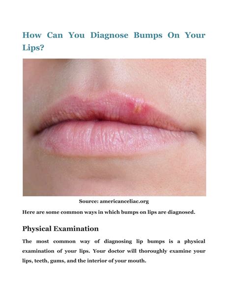 PPT - Bump On Lip: Check Out The Causes And Its Treatment PowerPoint Presentation - ID:11400451