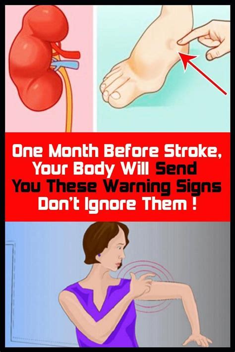 One Month Before Stroke, Your Body Will Send You These Warning Signs - Don't Ignore Them ! en 2020