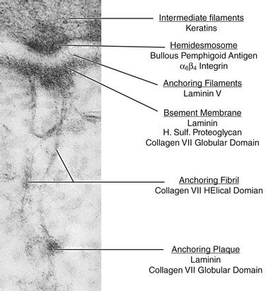 Corneal Epithelial Adhesion Disorders | Ento Key