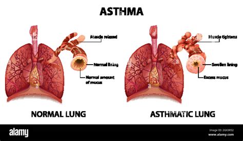 Normal lungs Stock Vector Images - Alamy