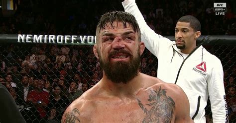 Pics: Perry undergoes nose surgery following painful UFC Uruguay loss - MMAmania.com