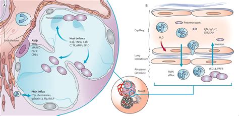 Pathogenesis, treatment, and prevention of pneumococcal pneumonia - The ...