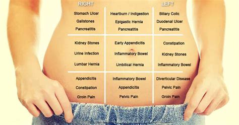 Decode Your Abdominal Pain with This Simple Map