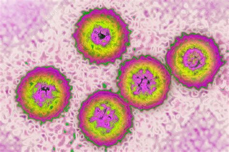 Cytomegalovirus - Stock Image - C035/4449 - Science Photo Library