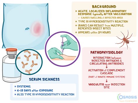 insecto Alienación parcialidad serum sickness mechanism estático Pickering crisantemo