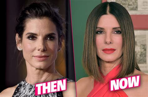 Sandra Bullock Frozen Face Result Of 'Fillers & Botox' Overload, Docs Claim