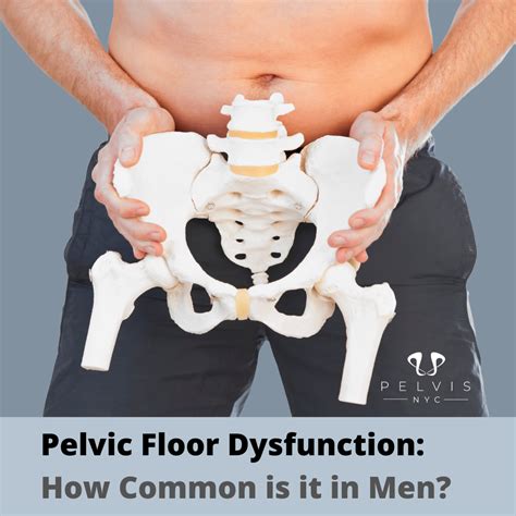 Pelvic Floor Dysfunction: How Common is it in Men? - Pelvis.nyc