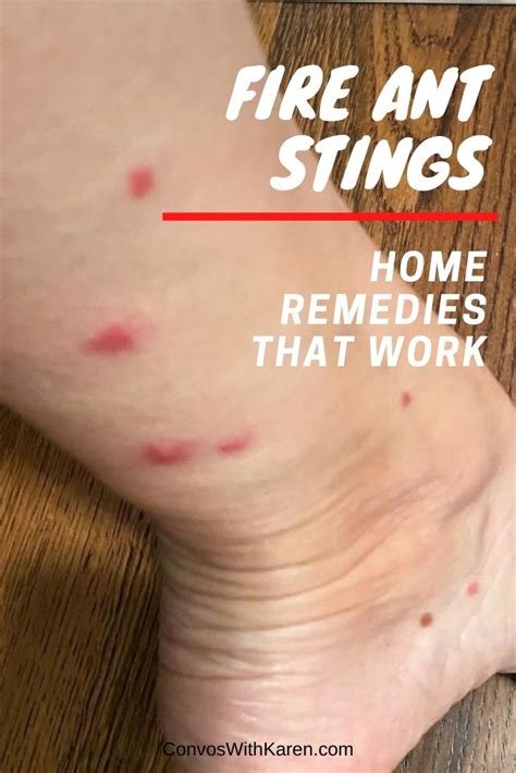 Home remedies for fire ant bites that really work - Convos with Karen