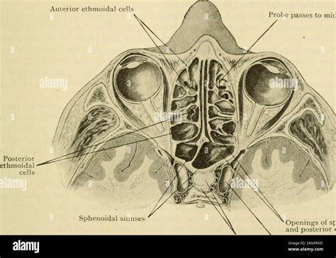 Ethmoidal air cells hi-res stock photography and images - Alamy