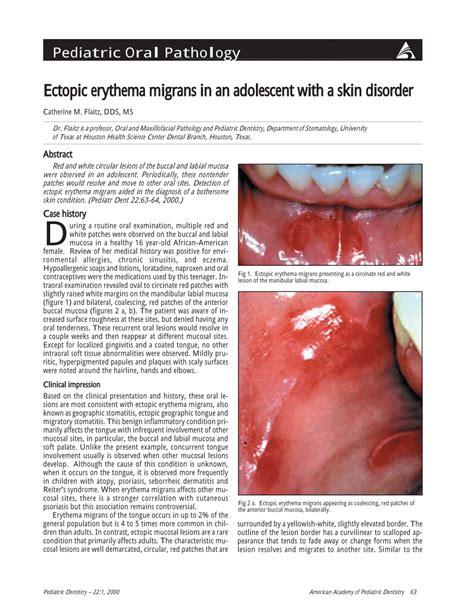 (PDF) Ectopic erythema migrans in an adolescent with a skin disorder