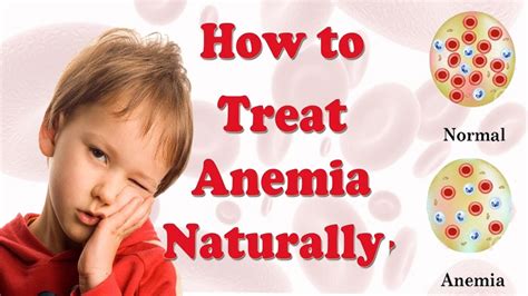 How to Treat Anemia Naturally at Home || Home Remedies for Anemia ...