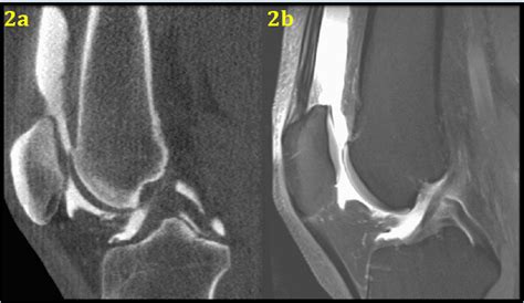 What Is Cone Beam CT? The Science Behind the Image. Part 1: Overview - CurveBeam