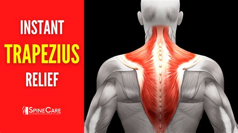 How to Fix Upper Trapezius Pain FOR GOOD | SpineCare