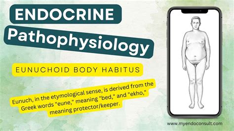 Eunuchoid Body Shape Or Habitus - My Endo Consult