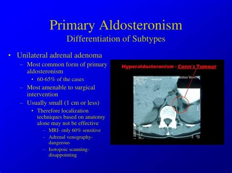 PPT - Hypertension associated with Endocrine Disorders PowerPoint ...