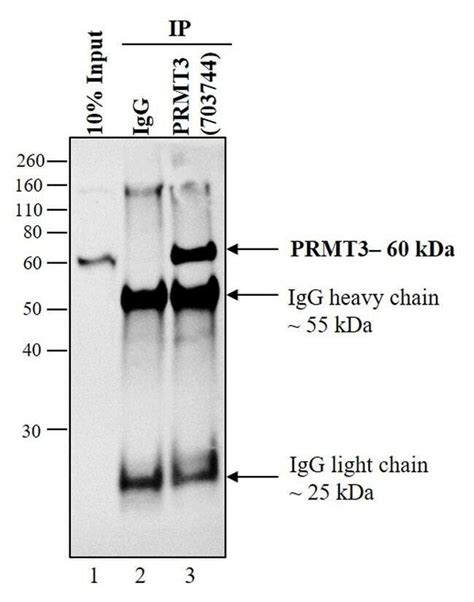 Antibodies for Immunoprecipitation (IP) | Thermo Fisher Scientific - IN