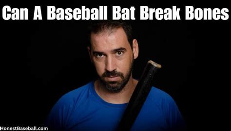 Can A Baseball Bat Break Bones? | Experts Openion | Honest Baseball