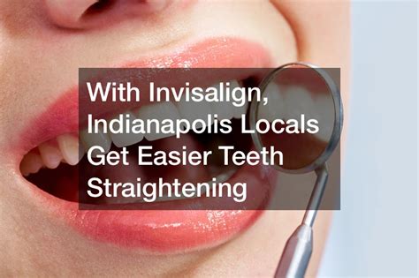 With Invisalign, Indianapolis Locals Get Easier Teeth Straightening