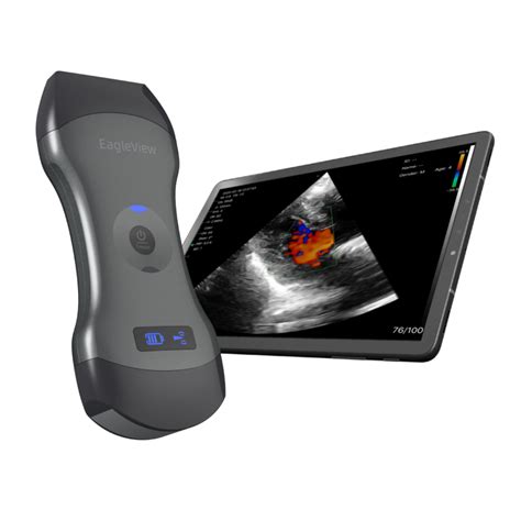 EagleView portable doppler ultrasound, whole-body point-of-care imaging on your palm. Ultrasound ...