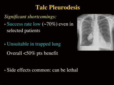 PPT - Malignant Pleural Effusion: Prevalence PowerPoint Presentation, free download - ID:1951844