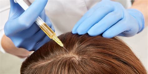 GFC PRP Hair Treatment in Mumbai, Cost - Best Hair Specialist