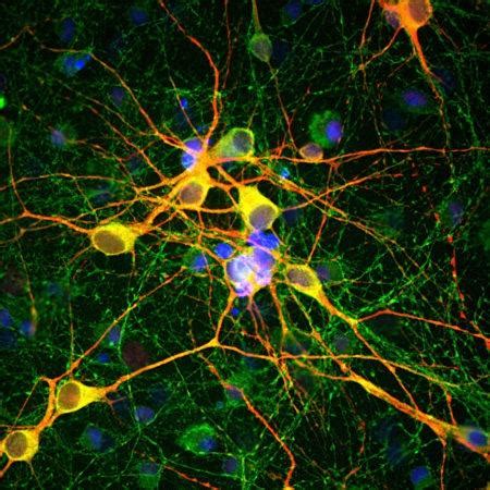 Anti-Microtubule Associated Protein 2, MAP2 Antibody | MAP2 | 34-1064