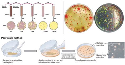 Pour Plate Technique- Procedure, Advantages, Limitations