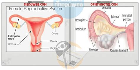 Fallopian tube (Uterine tube = Oviduct) Embryology - Anatomy - Histology - Meduweb