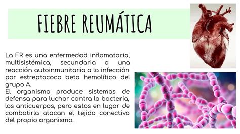 FIEBRE REUMÁTICA | Salud | Apuntes de medicina | uDocz