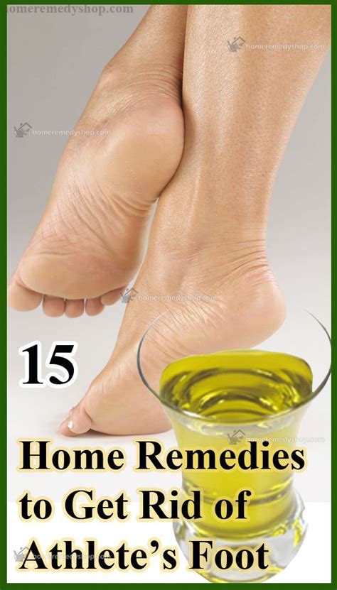 15 home remedies to get rid of athletes foot | Athletes foot remedies ...