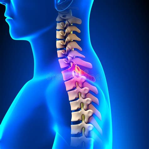 T1 Disc - Thoracic Spine Anatomy Stock Illustration - Illustration of person, highlighted: 50003403